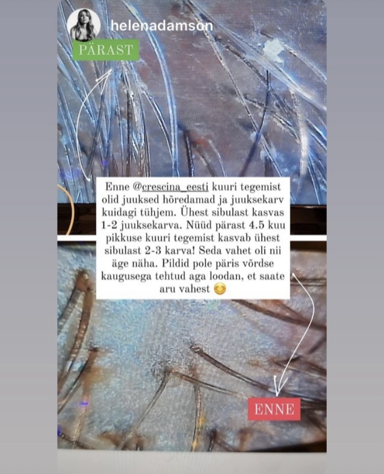 Crescina-Helen Adamson