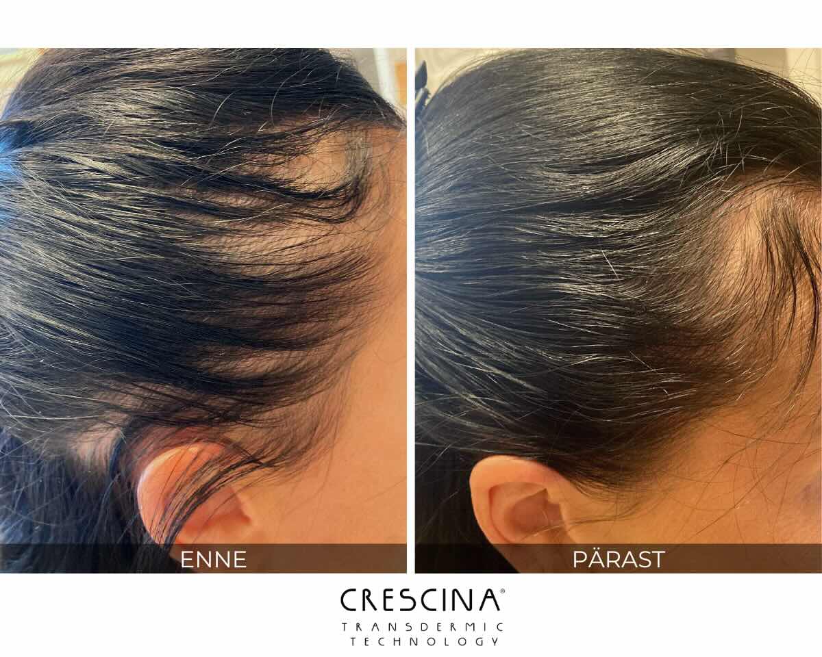 crescina-tulemus-naised